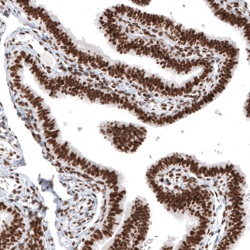 Histone H2AY/macroH2A.1 Antibody (CL5245) - Azide and BSA Free Immunohistochemistry-Paraffin: Histone H2AY/macroH2A.1 Antibody [NBP3-44248]