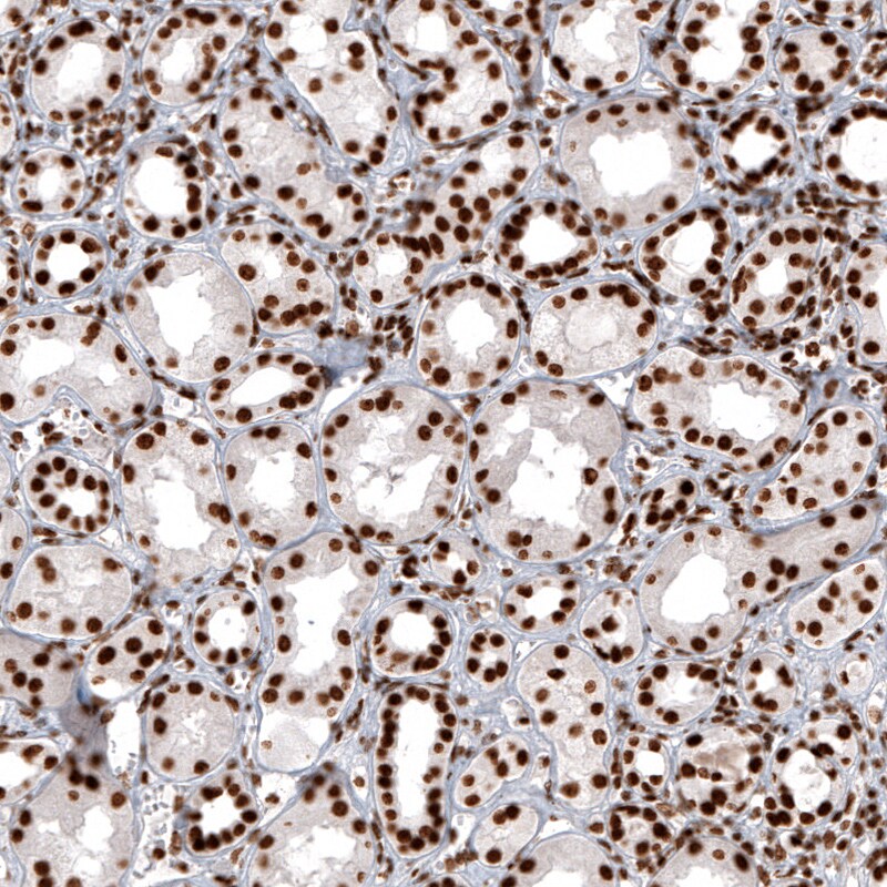 Histone H2AY/macroH2A.1 Antibody (CL5245) - Azide and BSA Free Immunohistochemistry-Paraffin: Histone H2AY/macroH2A.1 Antibody [NBP3-44248]