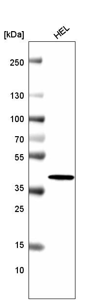 Histone H2AY/macroH2A.1 Antibody (CL5245) - Azide and BSA Free Western Blot: Histone H2AY/macroH2A.1 Antibody [NBP3-44248]