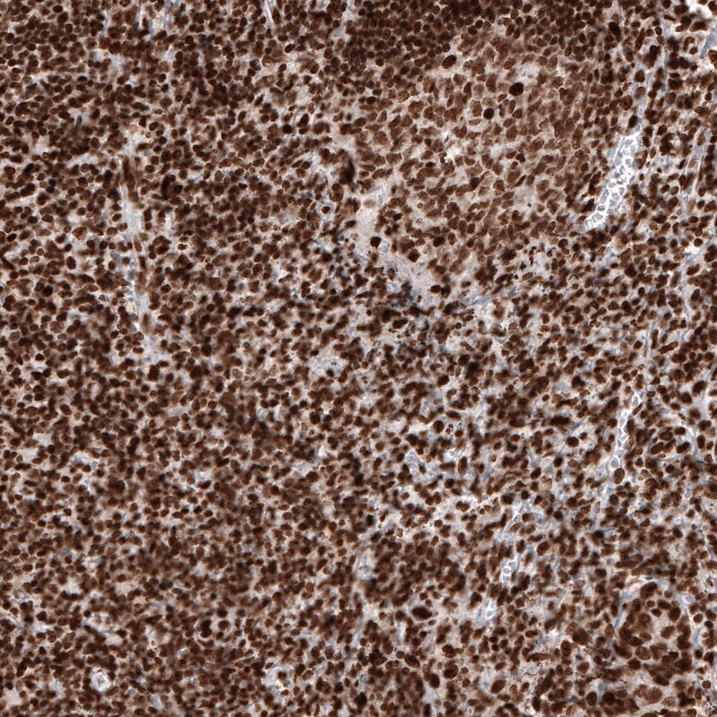 Histone H2AY/macroH2A.1 Antibody (CL5245) - Azide and BSA Free Immunohistochemistry-Paraffin: Histone H2AY/macroH2A.1 Antibody [NBP3-44248]