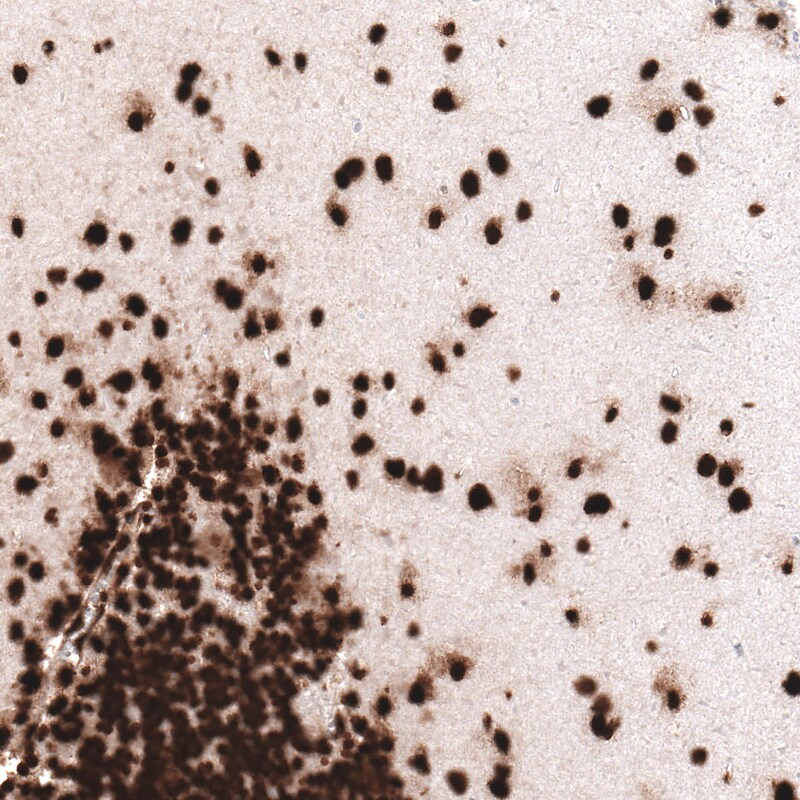 HIST1H3A Antibody (CL4967) - Azide and BSA Free Immunohistochemistry-Paraffin: HIST1H3A Antibody [NBP3-44249]