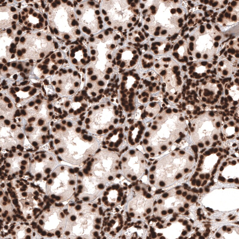 HIST1H3A Antibody (CL4967) - Azide and BSA Free Immunohistochemistry-Paraffin: HIST1H3A Antibody [NBP3-44249]