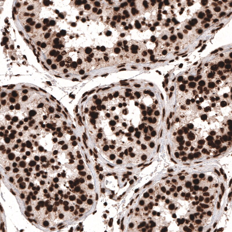 HIST1H3A Antibody (CL4967) - Azide and BSA Free Immunohistochemistry-Paraffin: HIST1H3A Antibody [NBP3-44249]