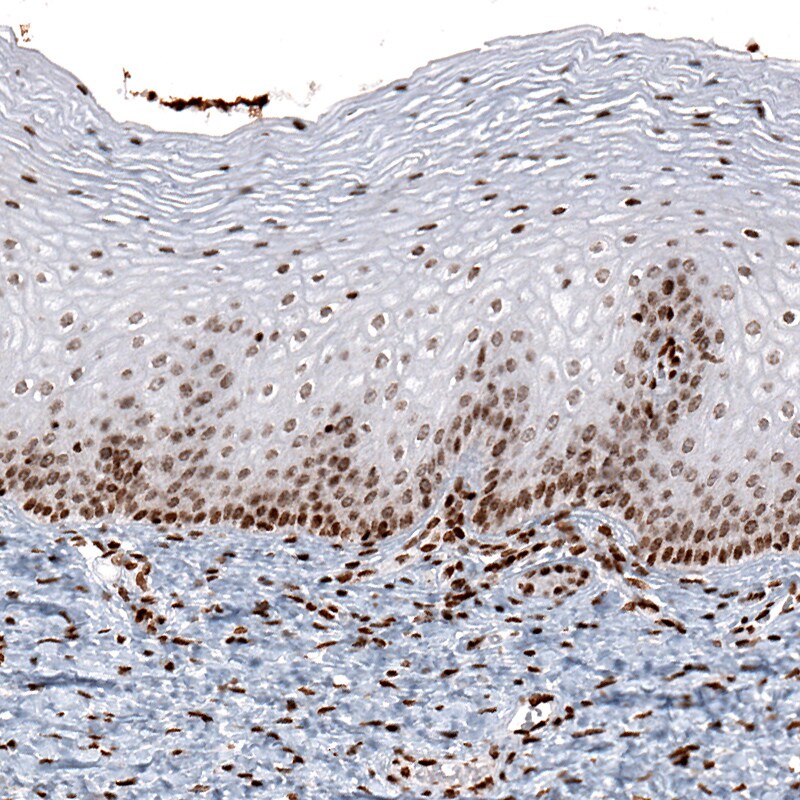 HIST1H2AG Antibody (CL5041) - Azide and BSA Free Immunohistochemistry-Paraffin: HIST1H2AG Antibody [NBP3-44252]