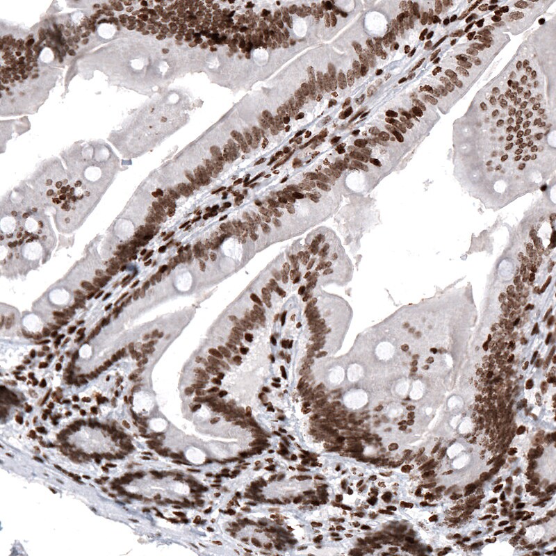 HIST1H2AG Antibody (CL5041) - Azide and BSA Free Immunohistochemistry-Paraffin: HIST1H2AG Antibody [NBP3-44252]
