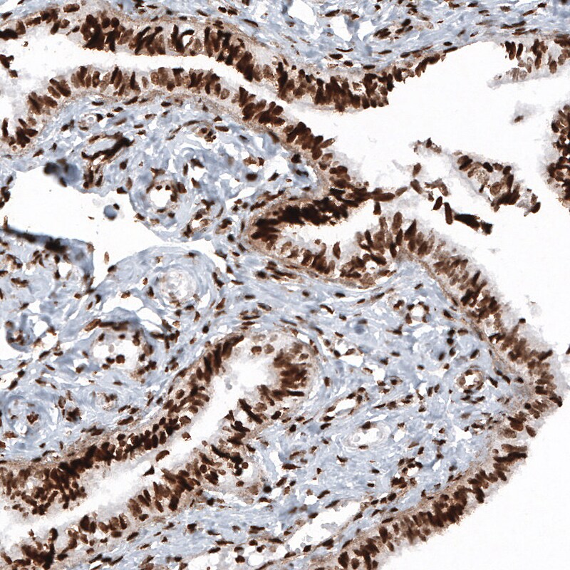 HIST1H2BC Antibody (CL5101) - Azide and BSA Free Immunohistochemistry-Paraffin: HIST1H2BC Antibody [NBP3-44254]