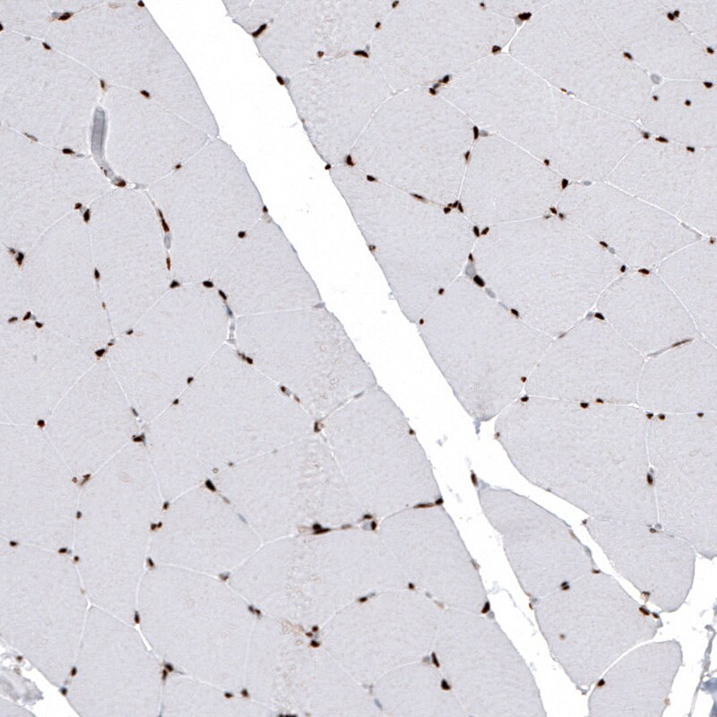 HIST1H2BC Antibody (CL5101) - Azide and BSA Free Immunohistochemistry-Paraffin: HIST1H2BC Antibody [NBP3-44254]