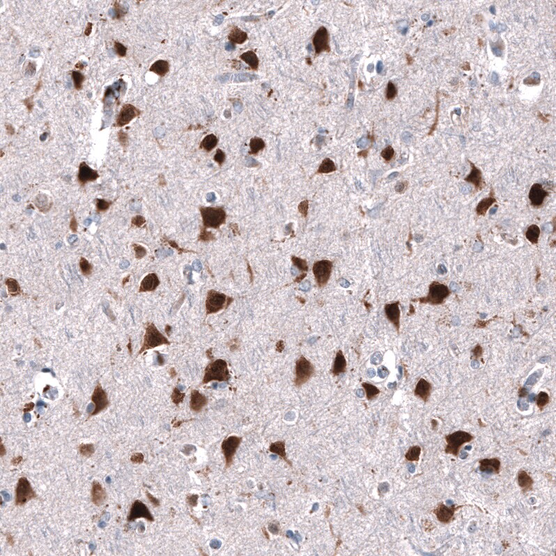 RBFOX3/NeuN Antibody (CL11896) - Azide and BSA Free Immunohistochemistry-Paraffin: RBFOX3/NeuN Antibody [NBP3-44255]