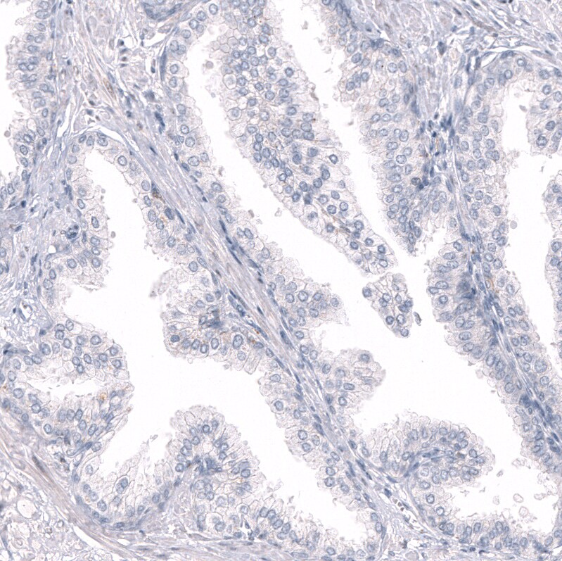 RBFOX3/NeuN Antibody (CL11896) - Azide and BSA Free Immunohistochemistry-Paraffin: RBFOX3/NeuN Antibody [NBP3-44255]