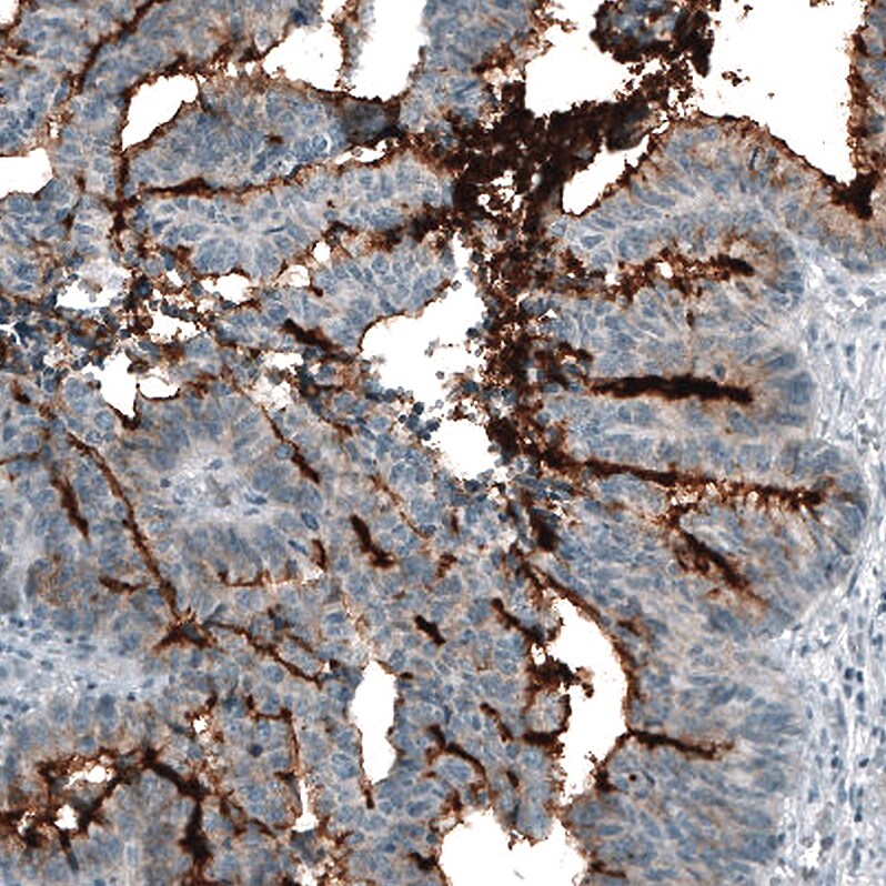 CD133 Antibody (CL7971) - Azide and BSA Free Immunohistochemistry-Paraffin: CD133 Antibody [NBP3-44257]