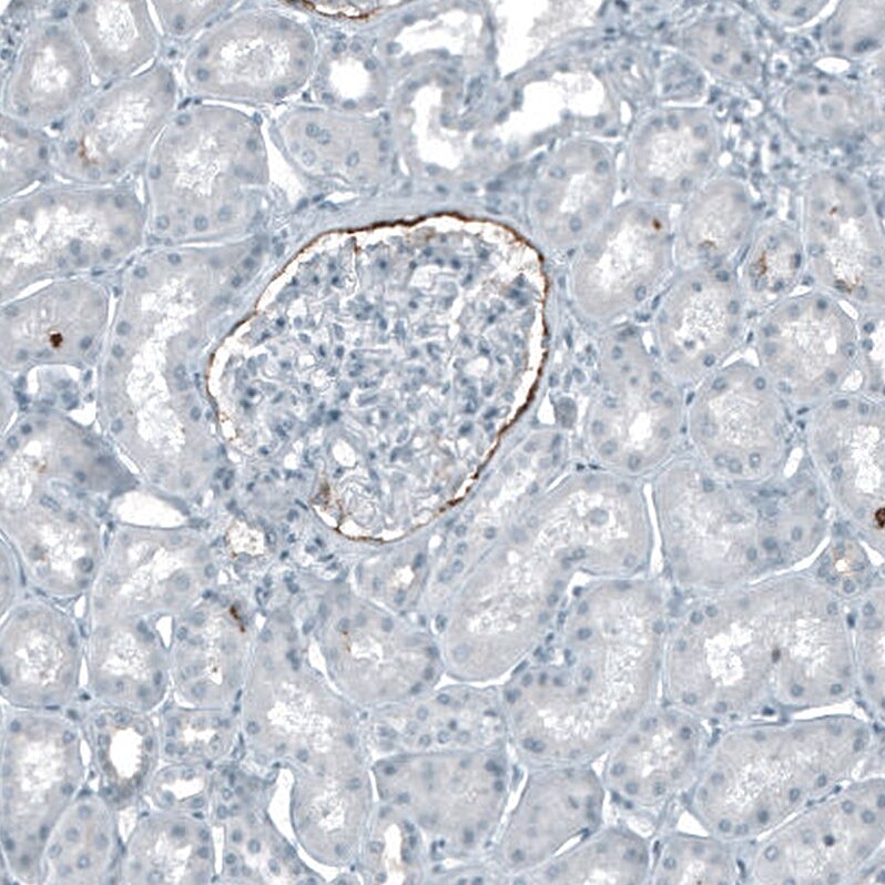 CD133 Antibody (CL7971) - Azide and BSA Free Immunohistochemistry-Paraffin: CD133 Antibody [NBP3-44257]