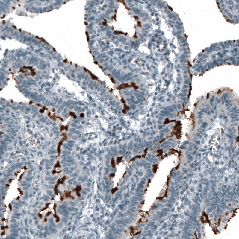 CD133 Antibody (CL7971) - Azide and BSA Free Immunohistochemistry-Paraffin: CD133 Antibody [NBP3-44257]