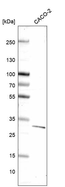 Dkk-1 Antibody (CL14707) - Azide and BSA Free Western Blot: Dkk-1 Antibody [NBP3-44259]