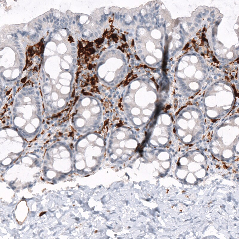 HLA DR/DP Antibody (CL10961) - Azide and BSA Free Immunohistochemistry-Paraffin: HLA DR/DP Antibody [NBP3-44260]