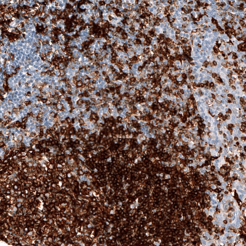 HLA DR/DP Antibody (CL10961) - Azide and BSA Free Immunohistochemistry-Paraffin: HLA DR/DP Antibody [NBP3-44260]