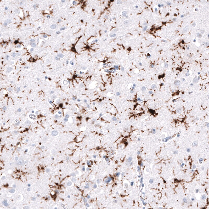 HLA DR/DP Antibody (CL10962) - Azide and BSA Free Immunohistochemistry-Paraffin: HLA DR/DP Antibody [NBP3-44261]