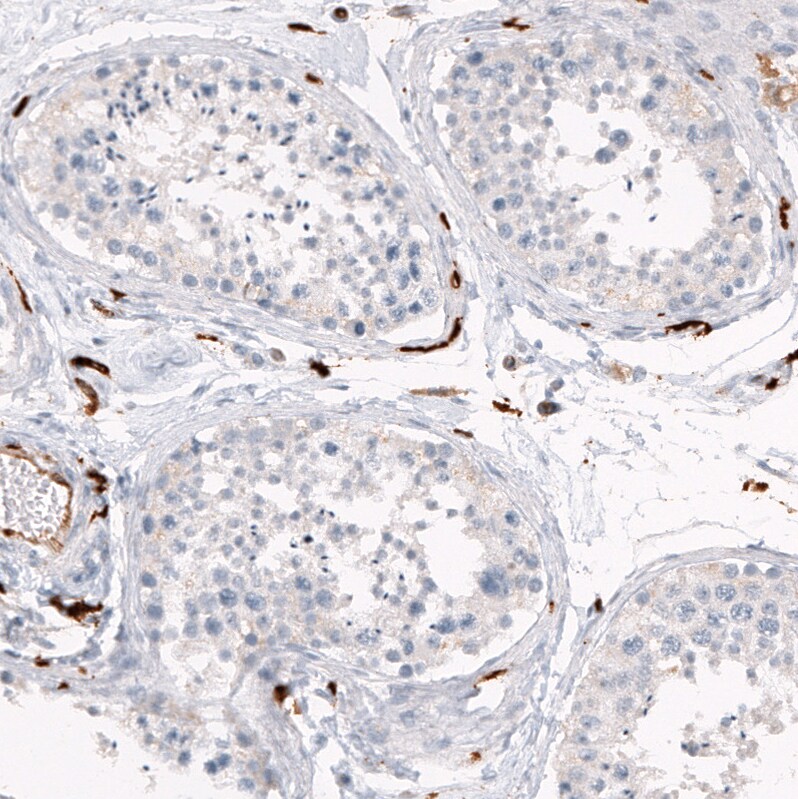 HLA DR/DP Antibody (CL10962) - Azide and BSA Free Immunohistochemistry-Paraffin: HLA DR/DP Antibody [NBP3-44261]