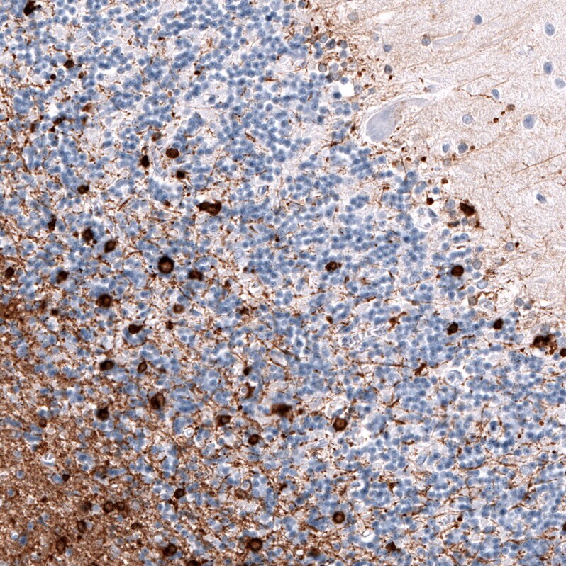 AlphaB Crystallin/CRYAB Antibody (CL10758) - Azide and BSA Free Immunohistochemistry-Paraffin: AlphaB Crystallin/CRYAB Antibody [NBP3-44262]