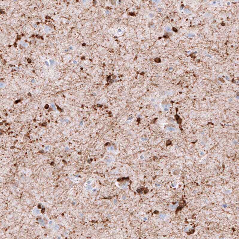 AlphaB Crystallin/CRYAB Antibody (CL10758) - Azide and BSA Free Immunohistochemistry-Paraffin: AlphaB Crystallin/CRYAB Antibody [NBP3-44262]