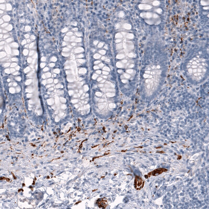 AlphaB Crystallin/CRYAB Antibody (CL10758) - Azide and BSA Free Immunohistochemistry-Paraffin: AlphaB Crystallin/CRYAB Antibody [NBP3-44262]