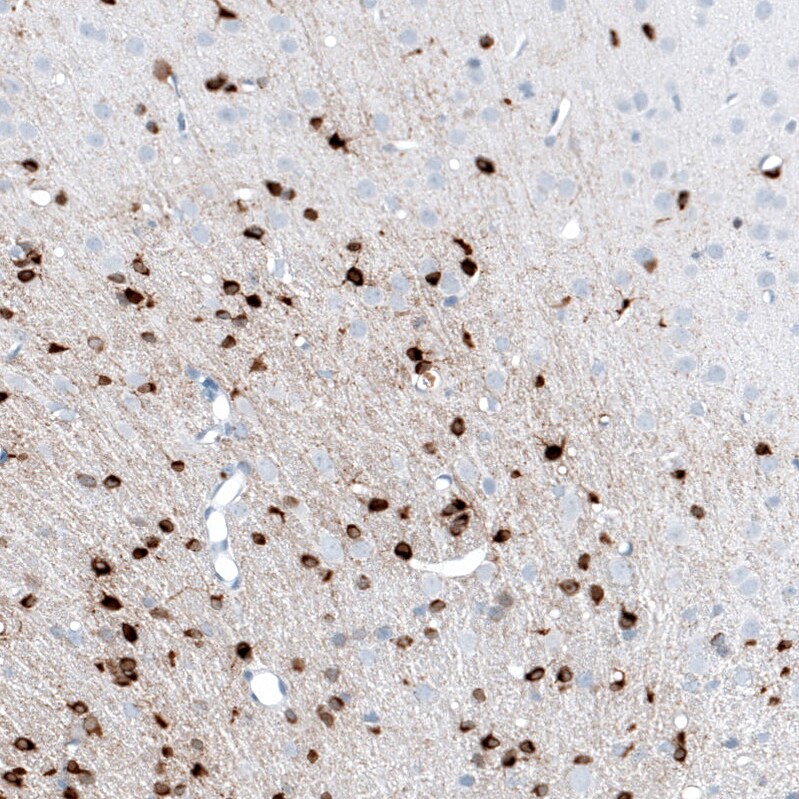AlphaB Crystallin/CRYAB Antibody (CL10758) - Azide and BSA Free Immunohistochemistry-Paraffin: AlphaB Crystallin/CRYAB Antibody [NBP3-44262]
