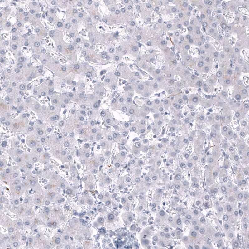 AlphaB Crystallin/CRYAB Antibody (CL10758) - Azide and BSA Free Immunohistochemistry-Paraffin: AlphaB Crystallin/CRYAB Antibody [NBP3-44262]