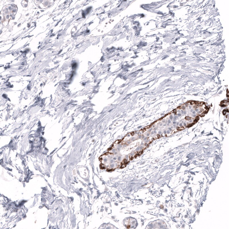 Cytokeratin 14 Antibody (CL14565) - Azide and BSA Free Immunohistochemistry-Paraffin: Cytokeratin 14 Antibody [NBP3-44263]