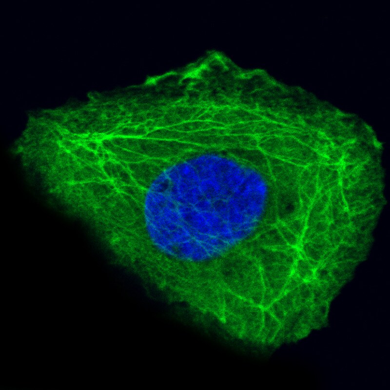 Cytokeratin 14 Antibody (CL14565) - Azide and BSA Free Immunocytochemistry/ Immunofluorescence: Cytokeratin 14 Antibody [NBP3-44263]