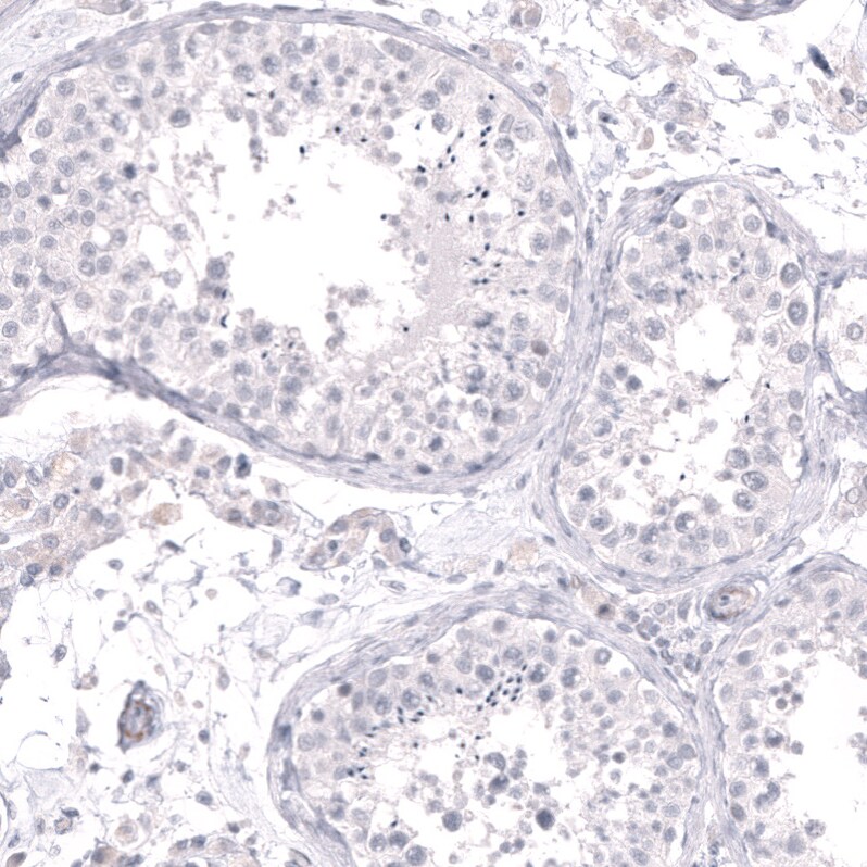 Cytokeratin 14 Antibody (CL14565) - Azide and BSA Free Immunohistochemistry-Paraffin: Cytokeratin 14 Antibody [NBP3-44263]
