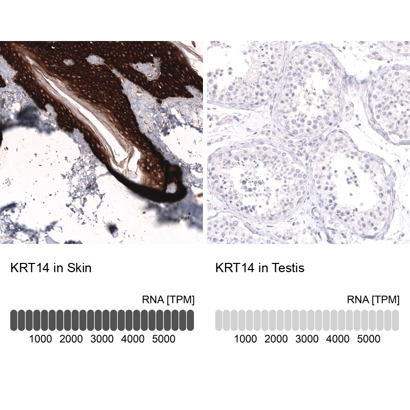 Cytokeratin 14 Antibody (CL14568) - Azide and BSA Free Immunohistochemistry-Paraffin: Cytokeratin 14 Antibody [NBP3-44264]