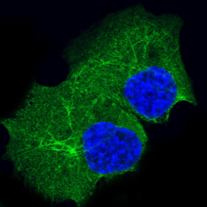 Cytokeratin 14 Antibody (CL14568) - Azide and BSA Free Immunocytochemistry/ Immunofluorescence: Cytokeratin 14 Antibody [NBP3-44264]
