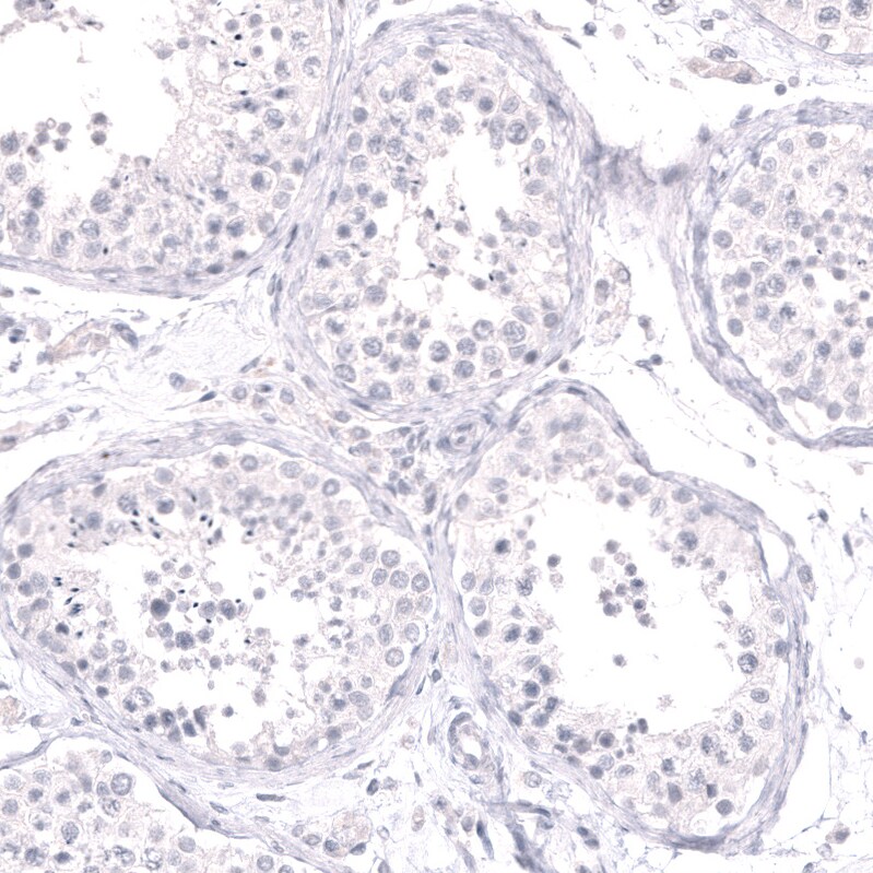 Cytokeratin 14 Antibody (CL14568) - Azide and BSA Free Immunohistochemistry-Paraffin: Cytokeratin 14 Antibody [NBP3-44264]