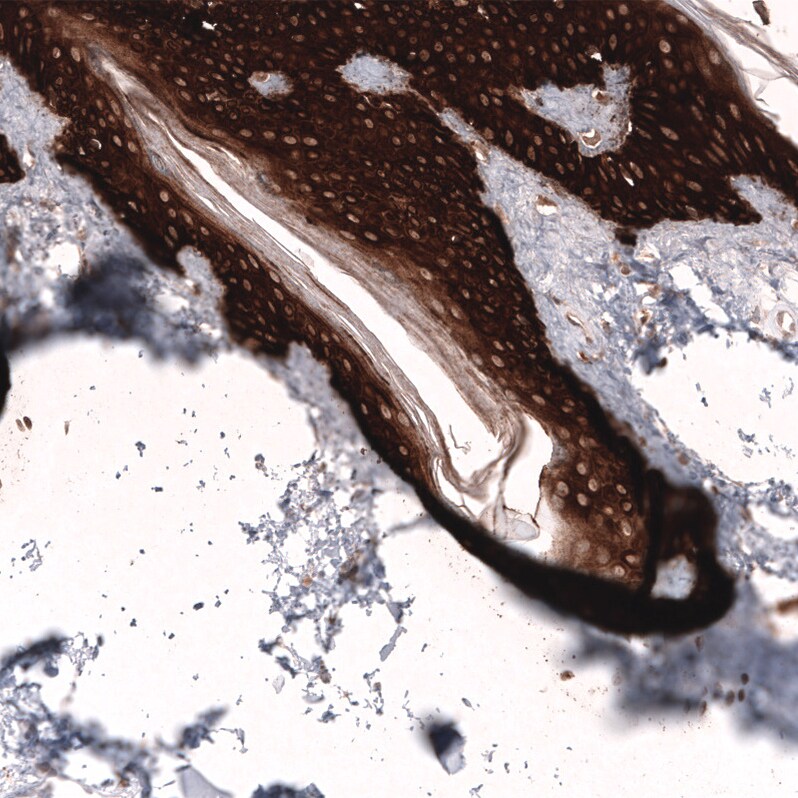 Cytokeratin 14 Antibody (CL14568) - Azide and BSA Free Immunohistochemistry-Paraffin: Cytokeratin 14 Antibody [NBP3-44264]
