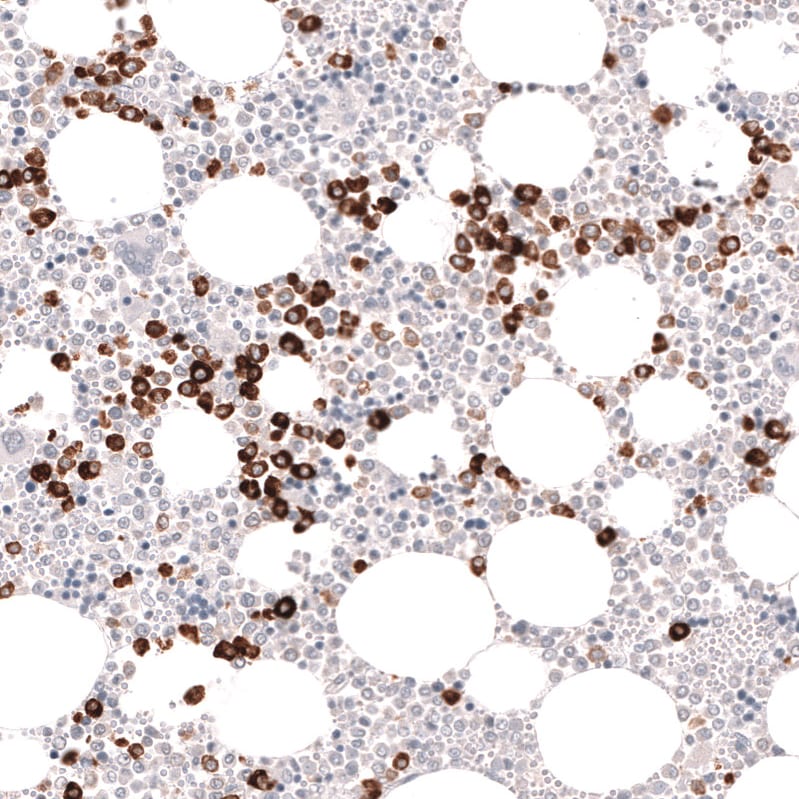 Myeloperoxidase/MPO Antibody (CL14991) - Azide and BSA Free Immunohistochemistry-Paraffin: Myeloperoxidase/MPO Antibody [NBP3-44266]