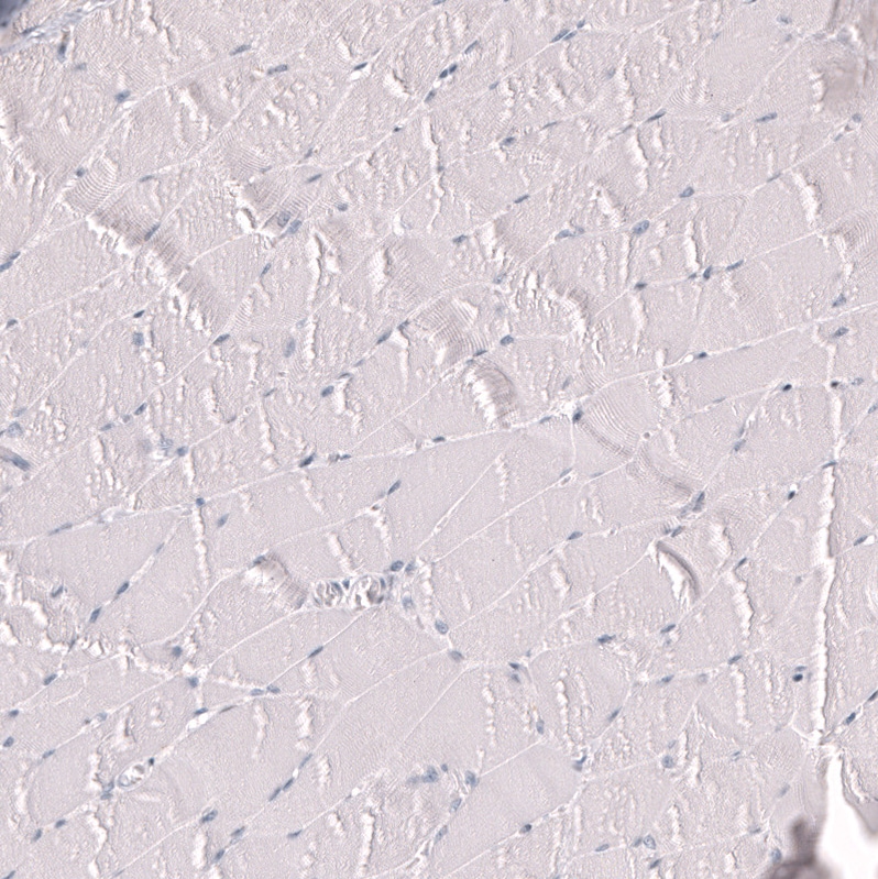 Myeloperoxidase/MPO Antibody (CL14991) - Azide and BSA Free Immunohistochemistry-Paraffin: Myeloperoxidase/MPO Antibody [NBP3-44266]
