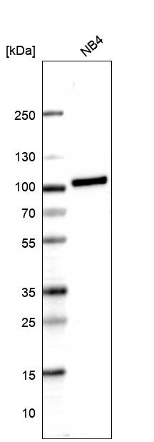 Myeloperoxidase/MPO Antibody (CL14991) - Azide and BSA Free Western Blot: Myeloperoxidase/MPO Antibody [NBP3-44266]