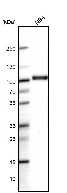 Myeloperoxidase/MPO Antibody (CL15002) - Azide and BSA Free Western Blot: Myeloperoxidase/MPO Antibody [NBP3-44267]