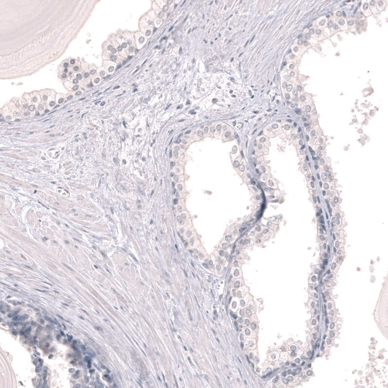 Myeloperoxidase/MPO Antibody (CL15002) - Azide and BSA Free Immunohistochemistry-Paraffin: Myeloperoxidase/MPO Antibody [NBP3-44267]