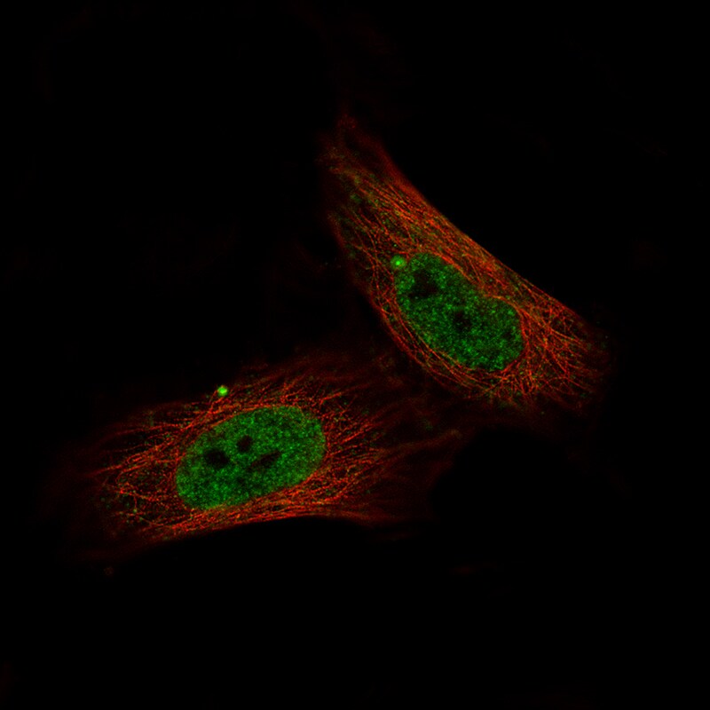 c-jun Antibody (CL9662) - Azide and BSA Free Immunocytochemistry/ Immunofluorescence: c-jun Antibody [NBP3-44268]