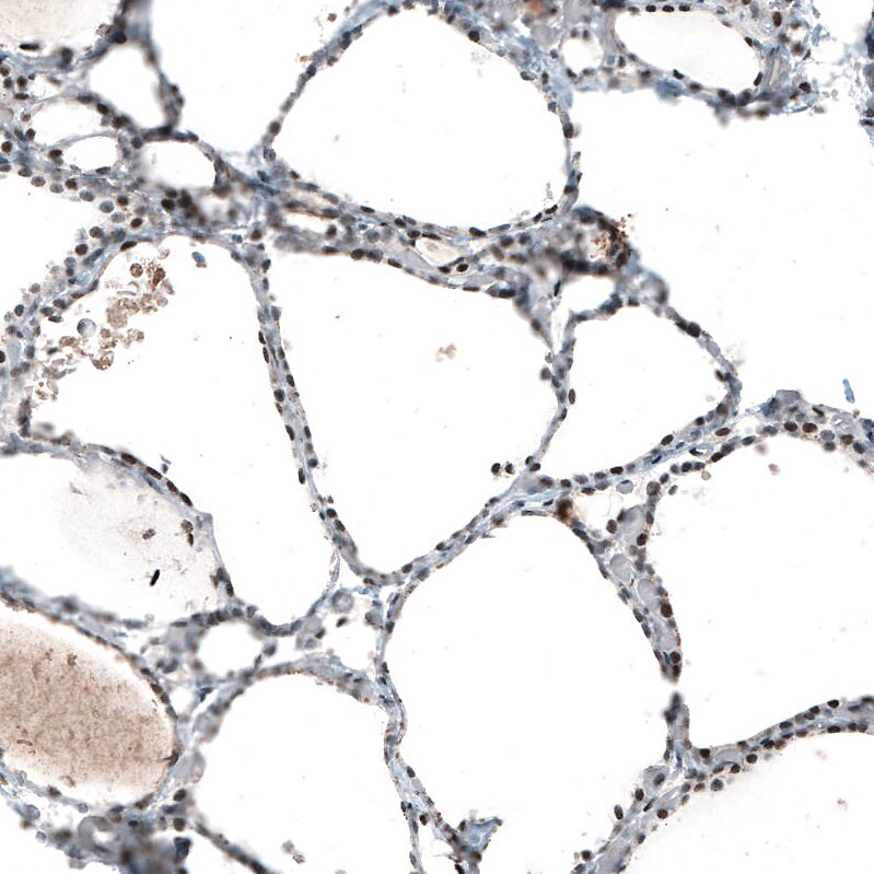c-jun Antibody (CL9662) - Azide and BSA Free Immunohistochemistry-Paraffin: c-jun Antibody [NBP3-44268]