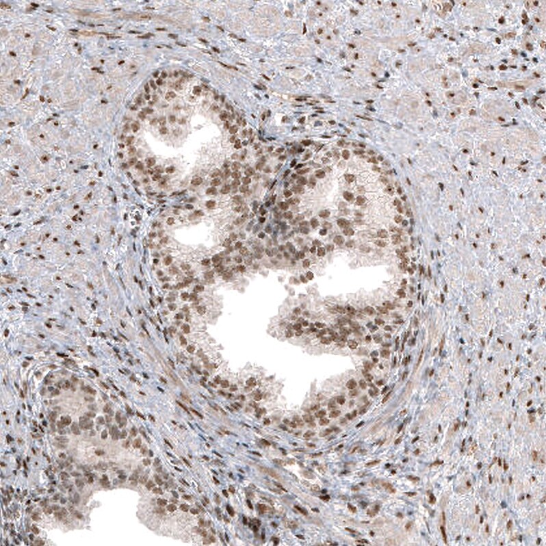 c-jun Antibody (CL9662) - Azide and BSA Free Immunohistochemistry-Paraffin: c-jun Antibody [NBP3-44268]