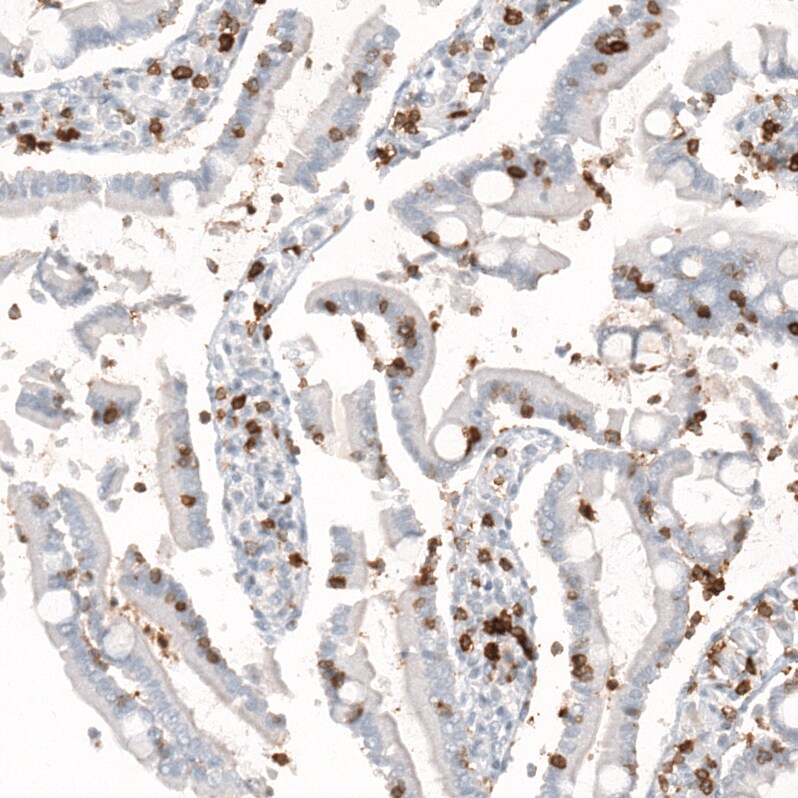 CD5 Antibody (CL12420) - Azide and BSA Free Immunohistochemistry-Paraffin: CD5 Antibody [NBP3-44269]