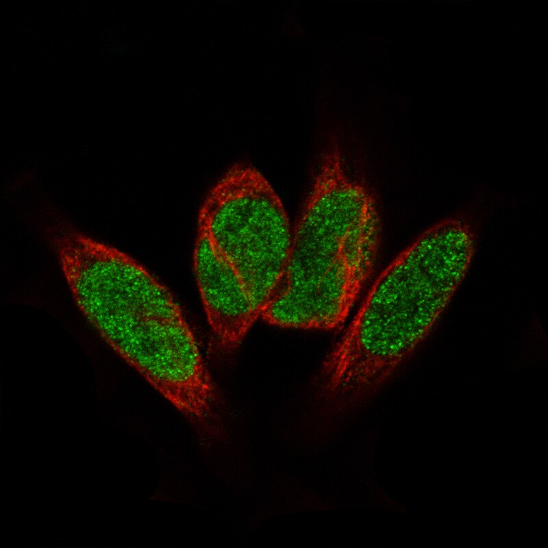 GLI-1 Antibody (CL12191) - Azide and BSA Free Immunocytochemistry/ Immunofluorescence: GLI-1 Antibody [NBP3-44270]