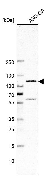 GLI-1 Antibody (CL12191) - Azide and BSA Free Western Blot: GLI-1 Antibody [NBP3-44270]