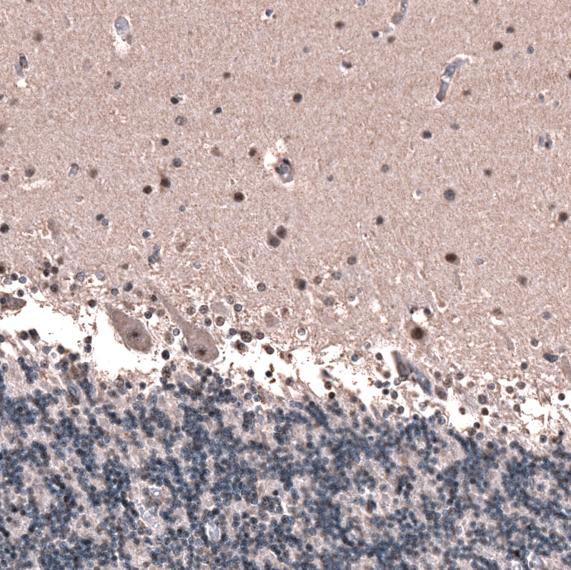 GLI-1 Antibody (CL12192) - Azide and BSA Free Immunohistochemistry-Paraffin: GLI-1 Antibody [NBP3-44271]
