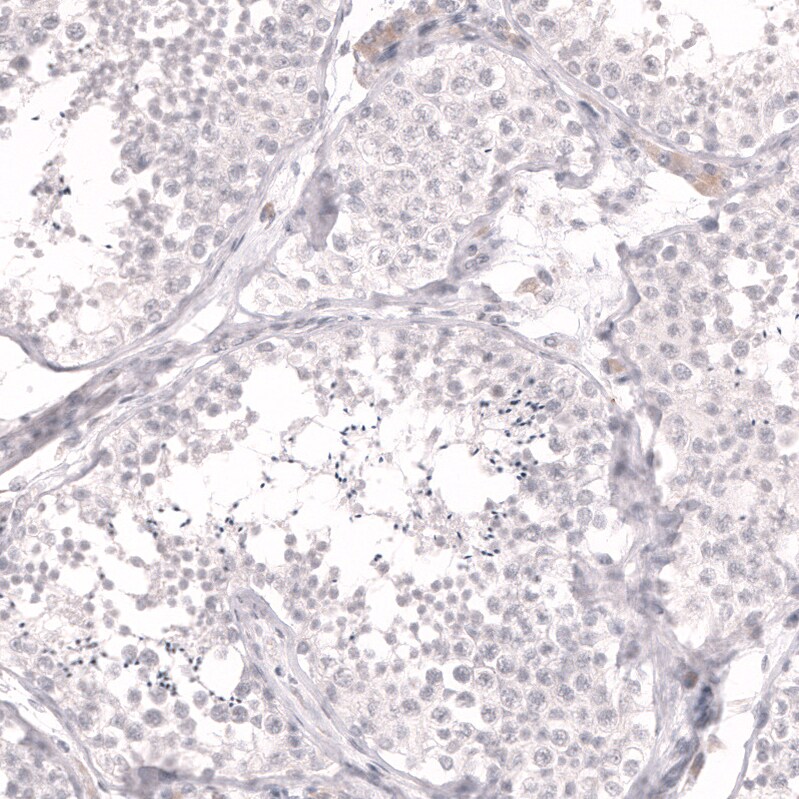 Lactase Antibody (CL14122) - Azide and BSA Free Immunohistochemistry-Paraffin: Lactase Antibody [NBP3-44272]