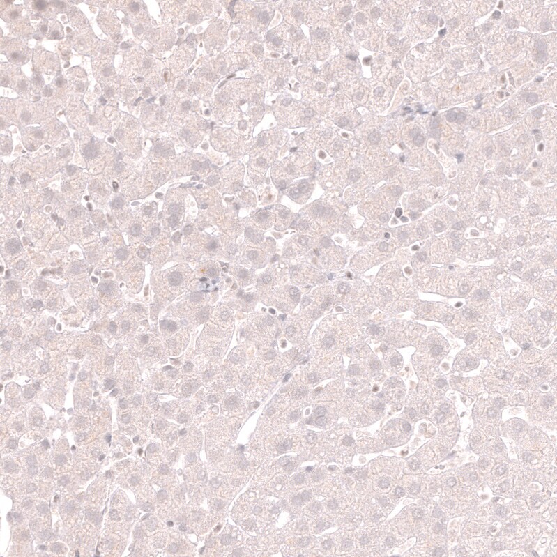 Lactase Antibody (CL14122) - Azide and BSA Free Immunohistochemistry-Paraffin: Lactase Antibody [NBP3-44272]