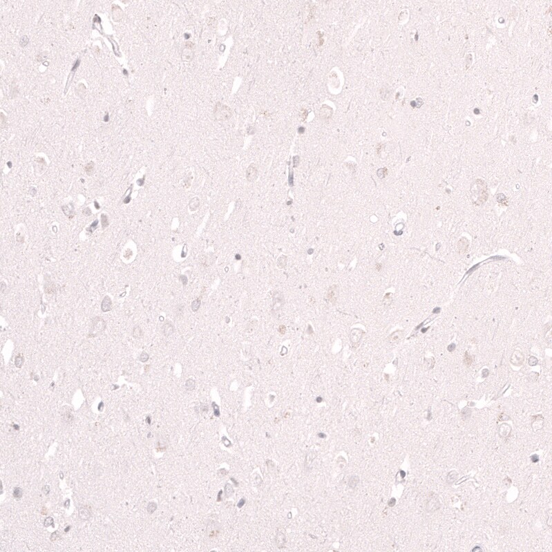 Lactase Antibody (CL14133) - Azide and BSA Free Immunohistochemistry-Paraffin: Lactase Antibody [NBP3-44273]
