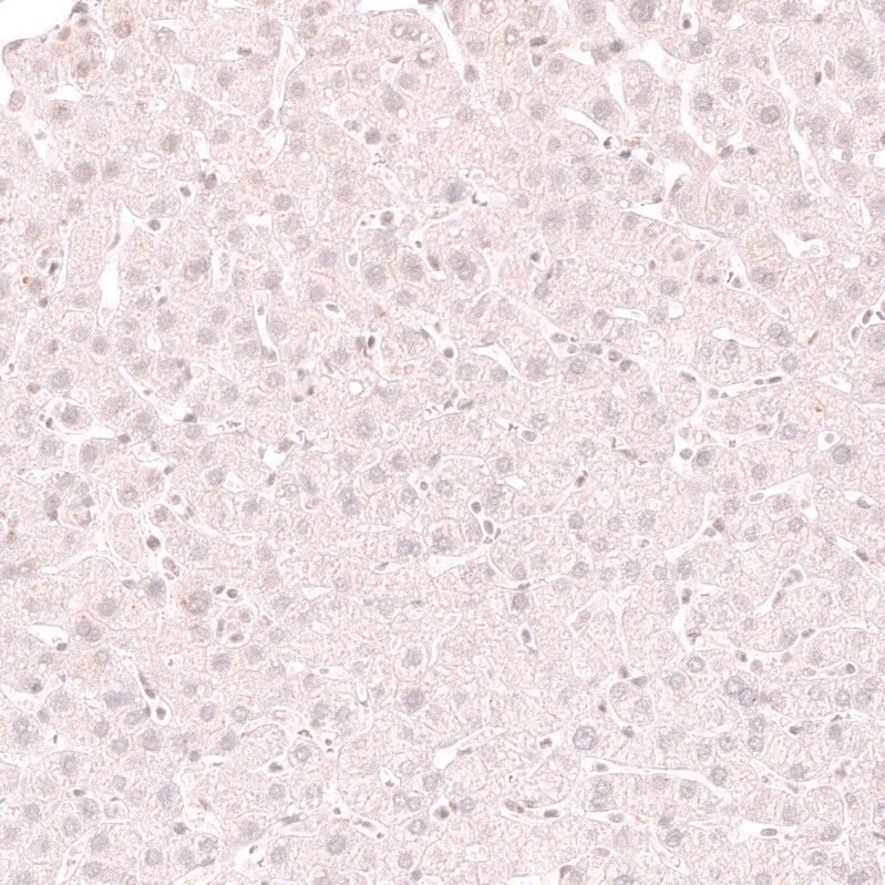 Lactase Antibody (CL14133) - Azide and BSA Free Immunohistochemistry-Paraffin: Lactase Antibody [NBP3-44273]