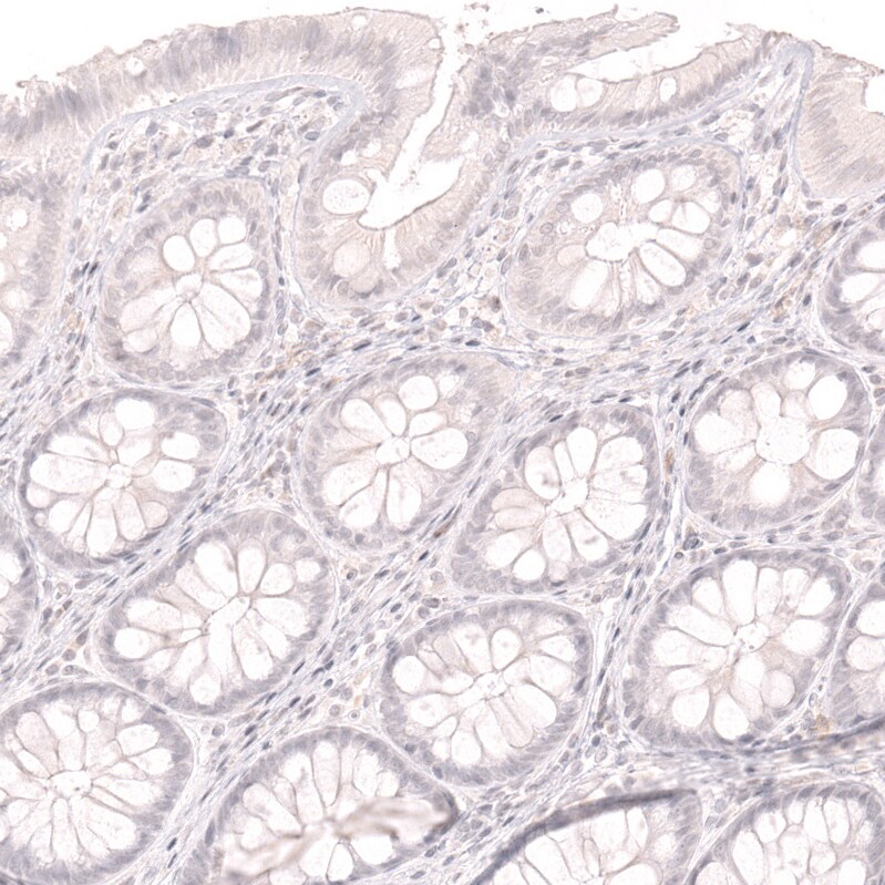 Lactase Antibody (CL14164) - Azide and BSA Free Immunohistochemistry-Paraffin: Lactase Antibody [NBP3-44274]